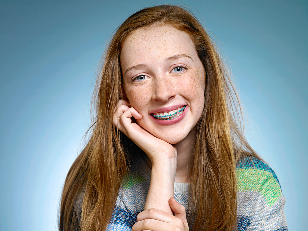 Smiling teen girl in braces, showing her beautiful smile